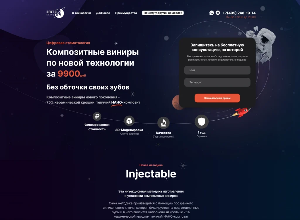 Композитные виниры